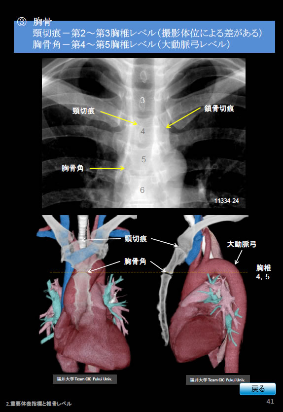 胸部Ｘ線写真、胸骨。